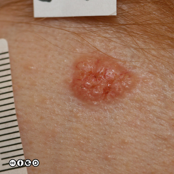 C580aH-C final 600px