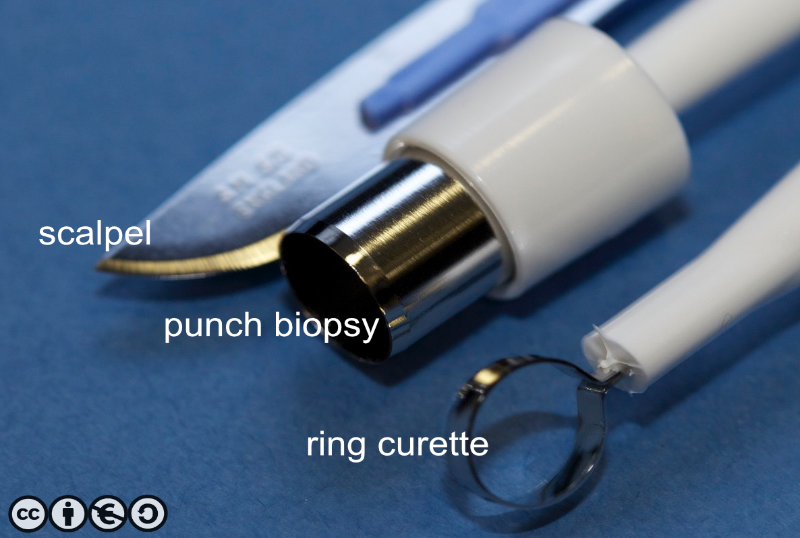 surgery excisions type instruments
