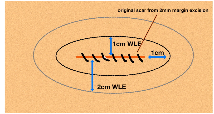 WLE 02