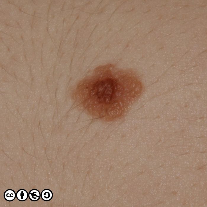 B1096final700px