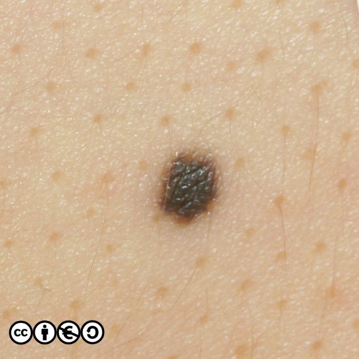 B1150final 700px B1150final 700px