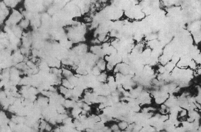 langerhans cells 700
