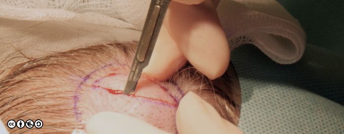 surgery image 002 700px