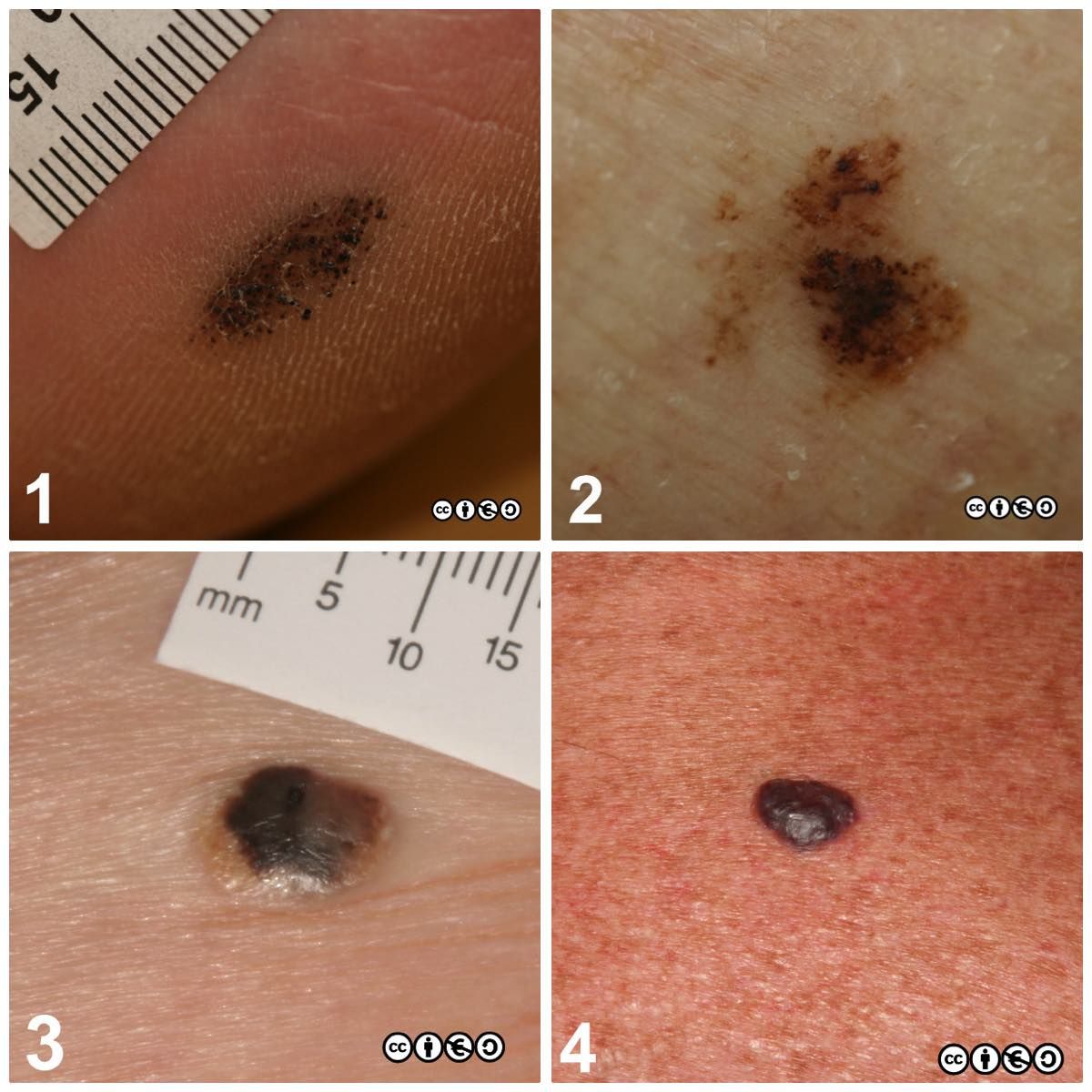 composite 2 trial