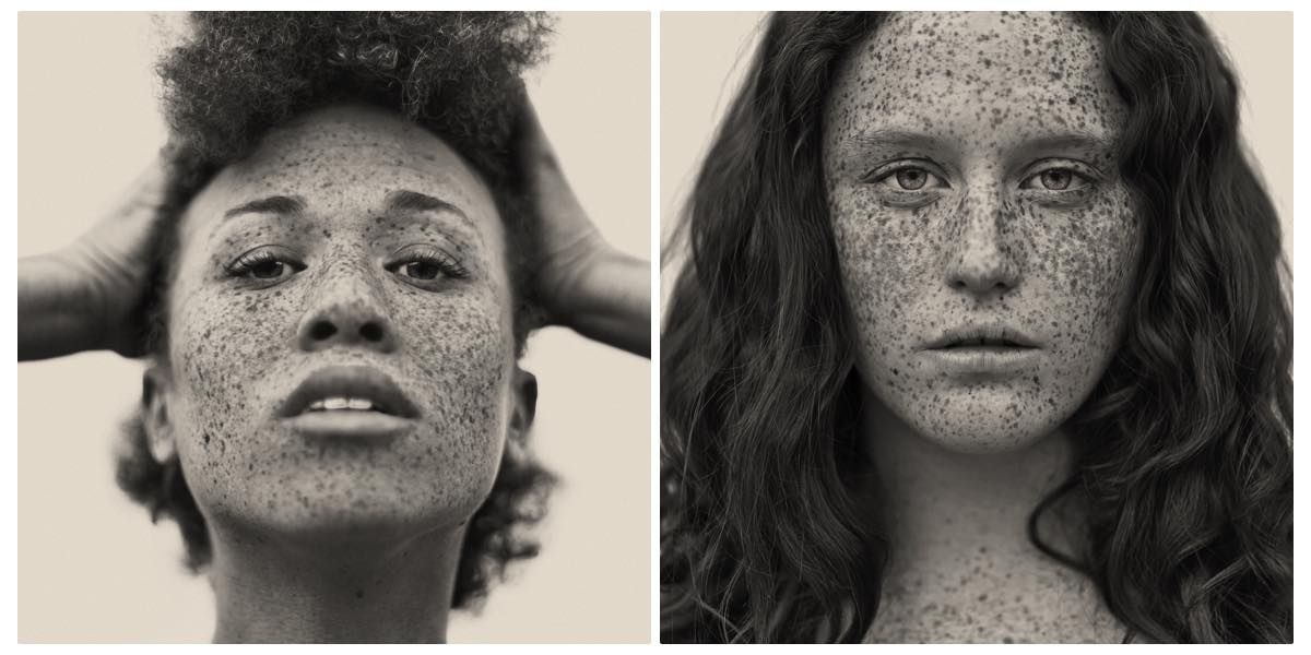 freckles reto caduff